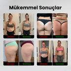 Selülit Önleyici Tayt | Fit Tight