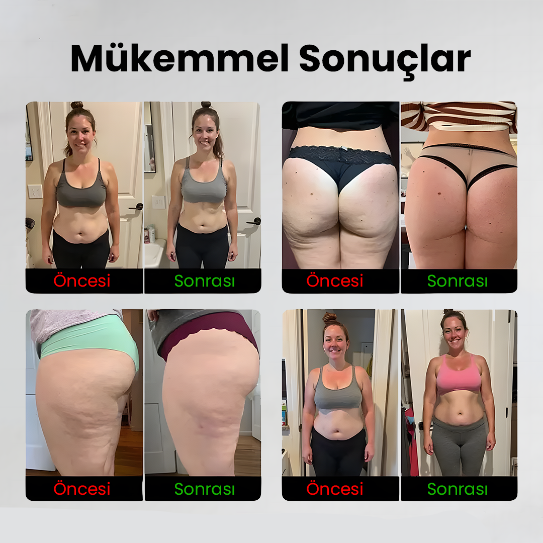 Selülit Önleyici Tayt | Fit Tight
